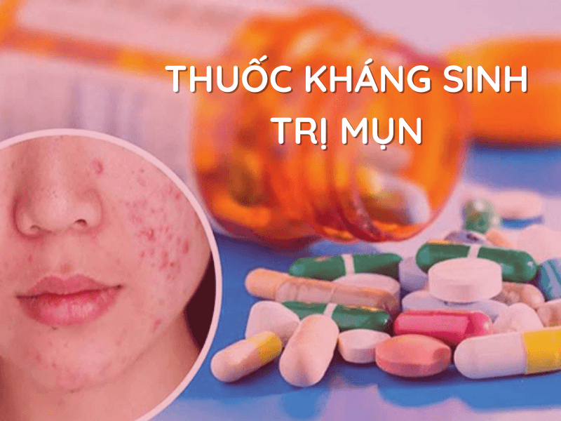 thuốc uống trị mụn viêm đỏ 